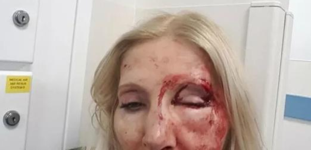 Woman Attacked In London