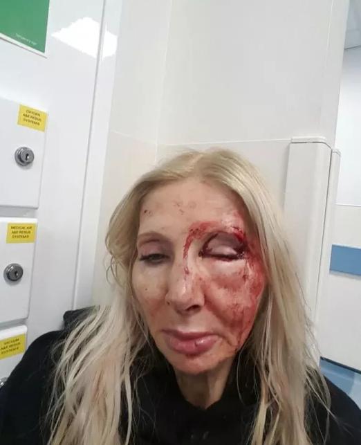 Woman Attacked In London