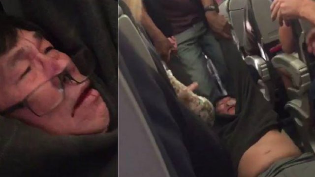 Doctor Dragged Off Plane